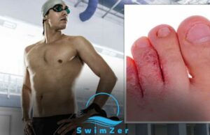 Can You Swim With a Toe Infection
