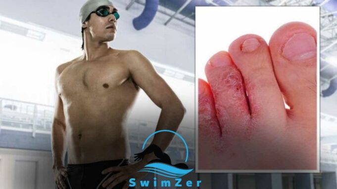 Can You Swim With a Toe Infection